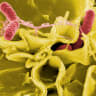  Salmonella bacteria, a common cause of foodborne disease, invade an immune cell.