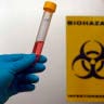  A technician poses for the media with a test tube for testing against pandemic influenza A (H1N1) virus in the national reference laboratory at the Robert Koch scientific institute in Berlin, October 2, 2009