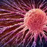 Concepto anatómico de la propagación de las células cancerosas y la oncología, o del crecimiento maligno y la metástasis, representado mediante una ilustración en 3D que muestra el crecimiento de las células tumorales y la propagación de la enfermedad maligna a través de la metástasis. 