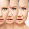 Aging process 