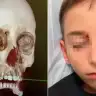 An 11-year-old was injured by an arrow to the head at camp in Israel. Images shared by the family.