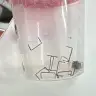 Staples found in a six-month-old's esophagus.