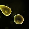 Naegleria fowleri