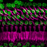 THE NORMAL, healthy cellular architecture of the inner ear.