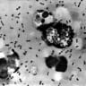  A bubonic plague smear, prepared from a lymph removed from an adenopathic lymph node, or bubo, of a plague patient, demonstrates the presence of the Yersinia pestis bacteria that causes the plague in this undated photo. 