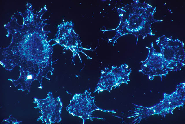 Cancer cells [illustrative] (photo credit: PIXABAY)