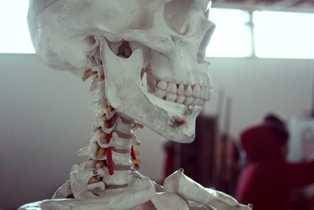  Human skull (illustrative). (photo credit: Wikimedia Commons)