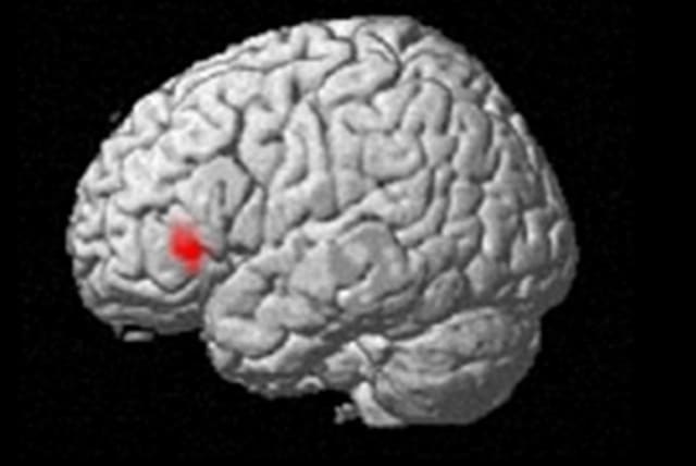  Scientists show that in the inferior frontal gyrus, neural activity differs in response to food images, depending on whether those images are presented consciously or unconsciously. this difference was associated with scores on eating behaviors such as emotional eating and restrained eating.  (photo credit: OSAKA METROPOLITAN UNIVERSITY)