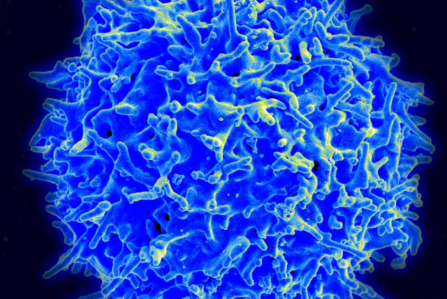  Scanning electron micrograph of a human T lymphocyte (also called a T cell) from the immune system of a healthy donor. (photo credit: NIAID/WIKIMEDIA COMMONS)