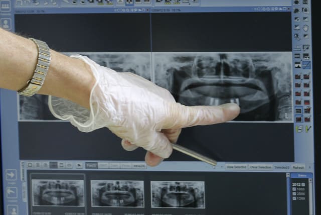 A dentist shows a radiograph of a mouth belonging to a U.S. patient, at a dental clinic in San Jose, November 1, 2012. (photo credit: JUAN CARLOS ULATE / REUTERS)
