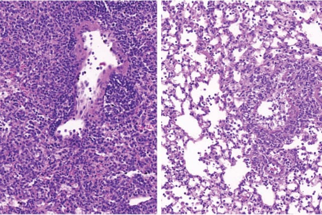  Lung tissue of a diabetic mouse (right) contains fewer immune cells (small purple dots) than that of a non-diabetic animal (left). (photo credit: WEIZMANN INSTITUTE OF SCIENCE)