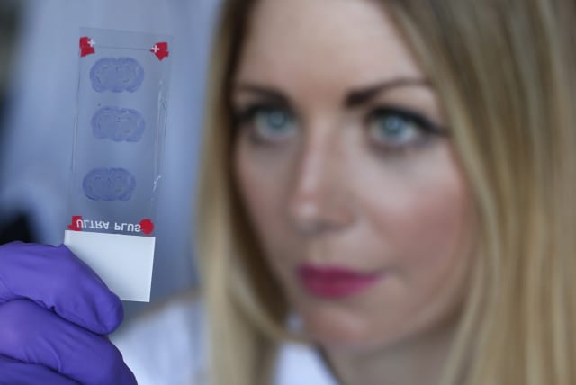  Graduate student Katie Bates studies a slice of rodent Parkinsonian brain tissue slices in the Nanomedicine Lab at UCL's School of Pharmacy in London. (photo credit:  REUTERS/Suzanne Plunkett)
