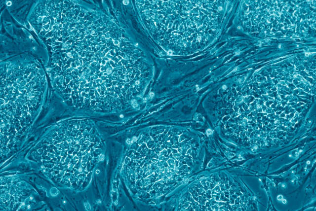  Human pluripotent stem cells. (photo credit: Prof. Nissim Benvenisty)