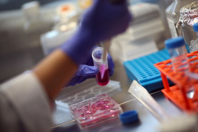  Un empleado trabaja con células madre en el laboratorio del doctor Ali Ertuerk en Múnich, Alemania 23 de abril de 2019. (photo credit: REUTERS/MICHAEL DALDER)
