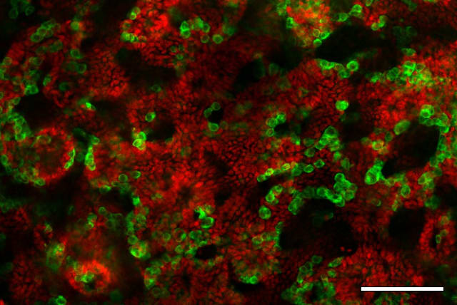  Testicular organoids generated from mice pups and incubated in a dish for 21 days. Sertoli cells, which are the cells responsible for the formation of the tubules in the testicle, appear in red and germ cells, which will produce the sperm cells, appear in green. Germ cells always stay close proximi (photo credit: Aviya Stopel)