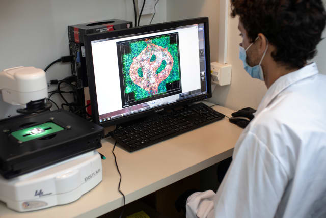  Israeli researcher Eilam Yeini examines a microscope image of a blood vessel tube surrounded by cancer tissues, as part of a brain cancer research that uses patients' cells to make 3D printed models of tumours, at Tel Aviv University, Israel August 17, 2021.  (photo credit: NIR ELIAS/REUTERS)