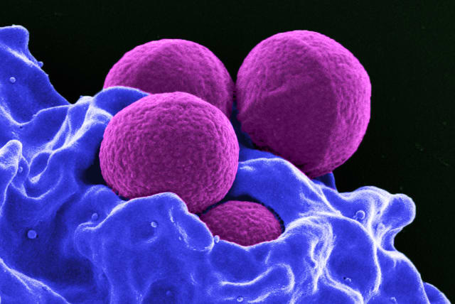  This digitally-colorized scanning electron micrograph depicts four magenta-colored, spherical methicillin-resistant Staphylococcus aureus (MRSA) bacteria in the process of being phagocytized by a blue-colored human white blood cells in this undated handout photo. (photo credit: NATIONAL INSTITUTE OF ALLERGY AND INFECTIOUS DISEASES - NIH/HANDOUT VIA REUTERS)
