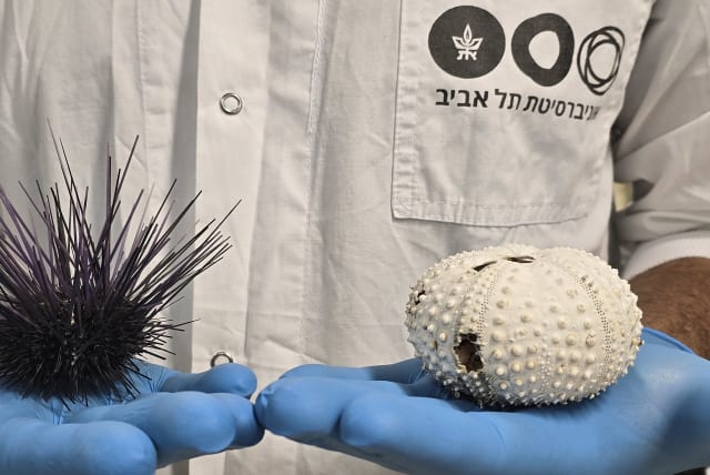  The sea urchin Diadema setosum before (left) and after (right) mortality. The white skeleton is exposed following tissue disintegration and loss of spines. (photo credit: TEL AVIV UNIVERSITY)